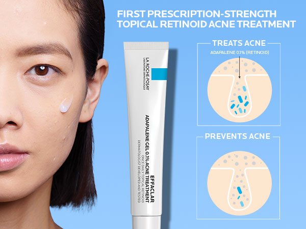How to Use Adapalene Gel for Acne