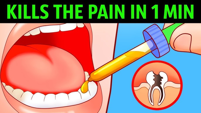 Broken Tooth Pain Relief
