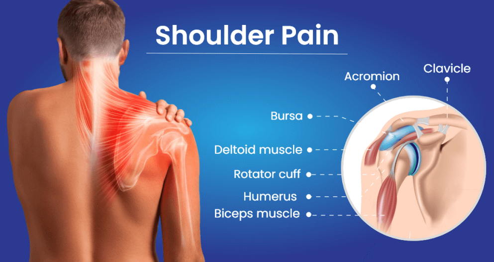 What is Shoulder Pain